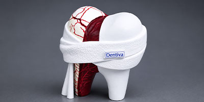 Dental anesthesia patch